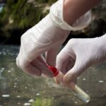 رغم اكتشاف الكوليرا مؤخرًا: نقص ميزانية وزارة الصحة يوقف فحص مياه الشرب