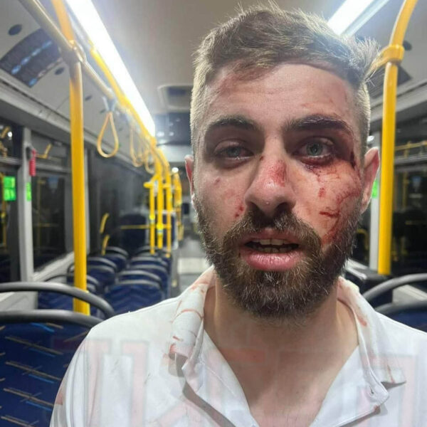 العنصرية في المجتمع الحريدي تتفشّى: في الأعراس يُغَنُّون “لتحترق قراكم”.. وفي الشوراع يرمون الحجارة على السائقين العرب
