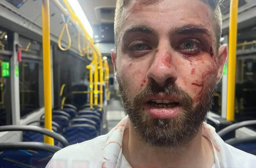 العنصرية في المجتمع الحريدي تتفشّى: في الأعراس يُغَنُّون "لتحترق قراكم".. وفي الشوراع يرمون الحجارة على السائقين العرب