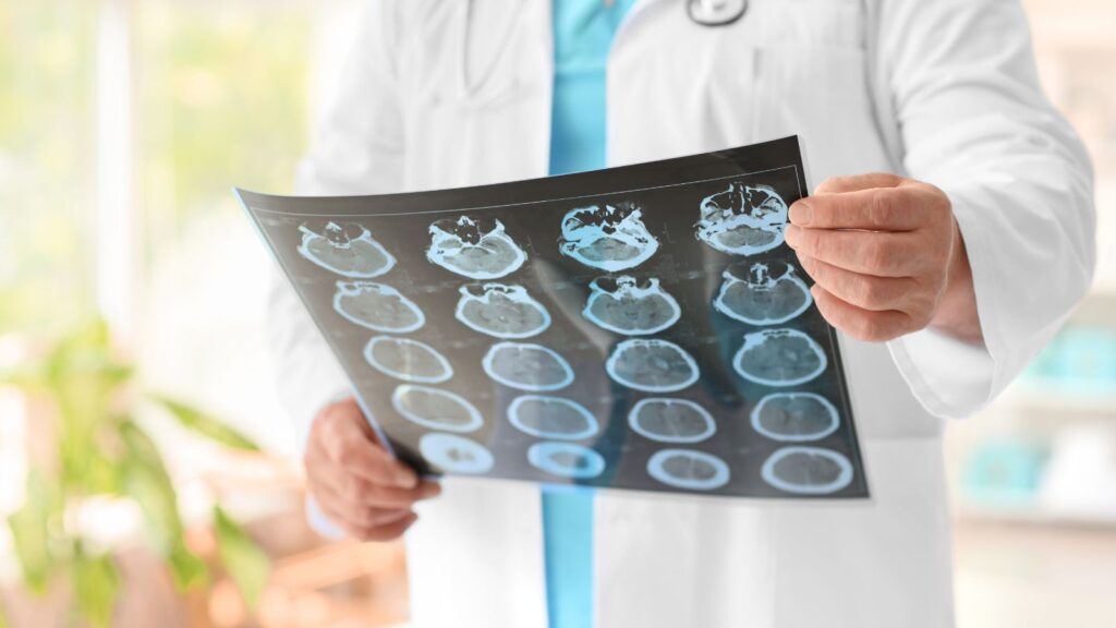 neurologist